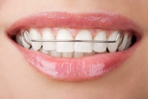 Orthodontic Hawley Retainer
