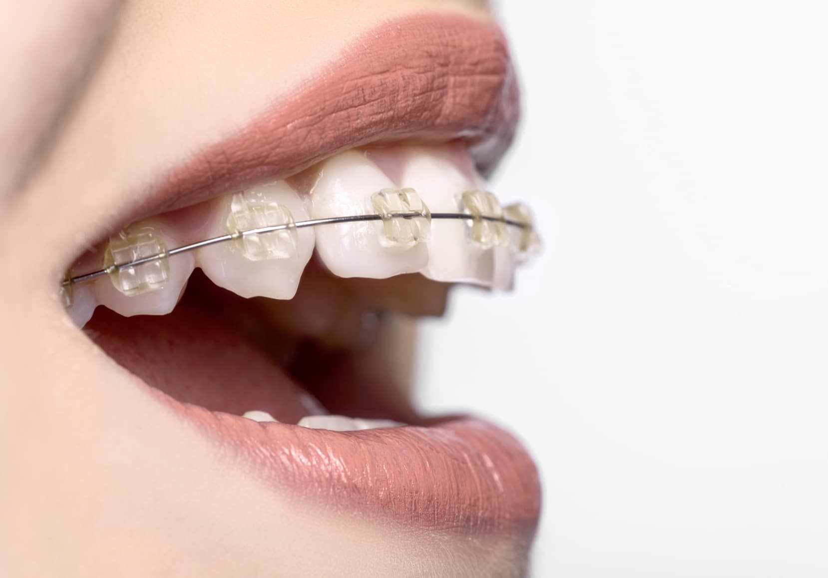 Best Orthodontist in Gungahlin