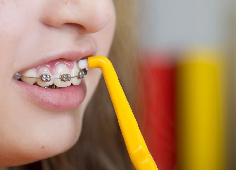 Cleaning your Teeth with Braces