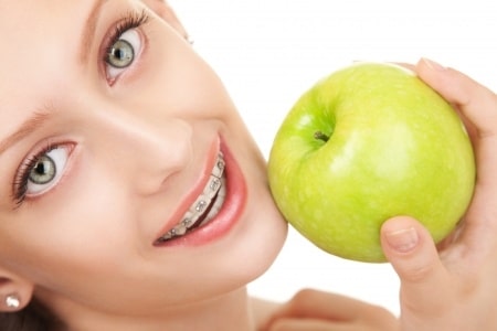 Young Lady in Braces with an apple
