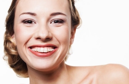 Smiling young woman with braces