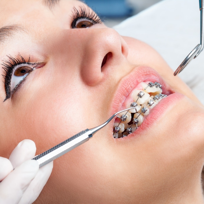 cost of orthodontist visit