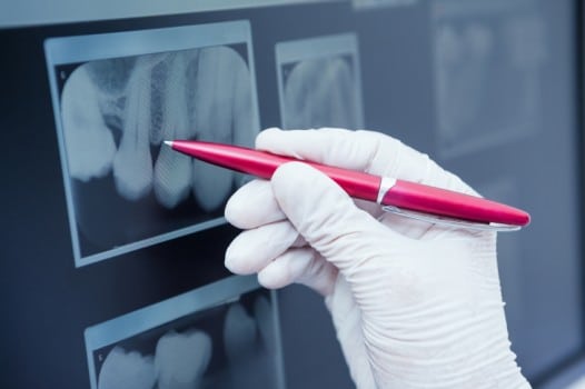 Dental Xray being examined