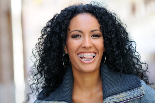 Woman in braces with tongue sticking out
