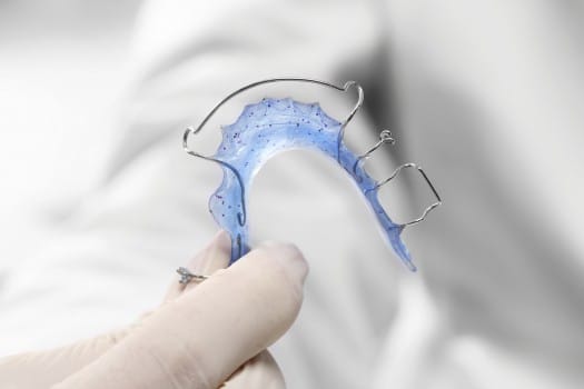 Orthodontist holding a colored dental retainer