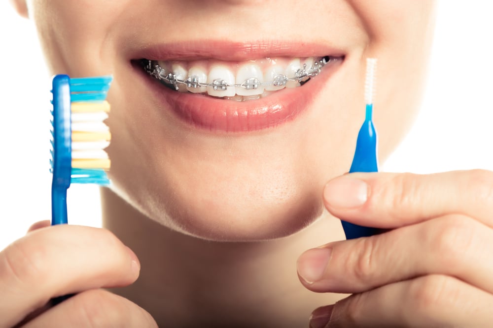 A Guide to Cleaning Teeth with Braces - Orthodontic Associates