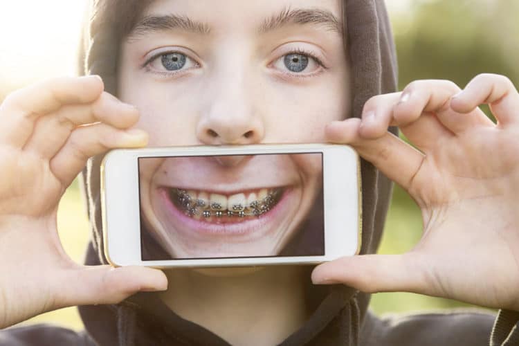Correct Jaw Surgery