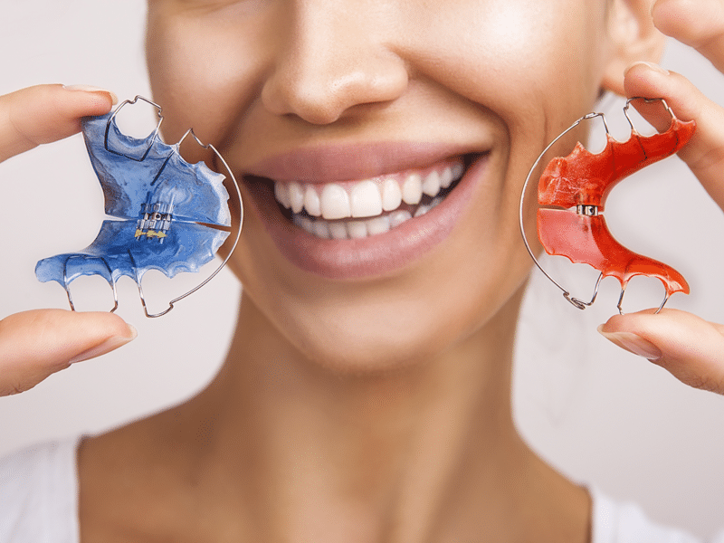 life-with-retainers-tgo-orthodontics