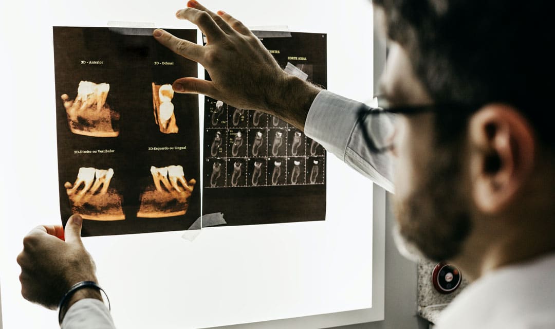 Dentist looking at X-rays